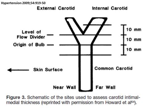 normal carotid intima media thickness